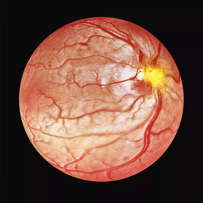 OpTek - Fiber Processing for Optical Coherence Tomography (OCT)